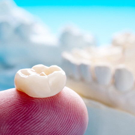 a close up of a single tooth dental crown sitting on a finger