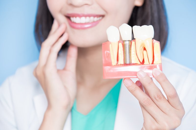 Dentist shows model of dental implant